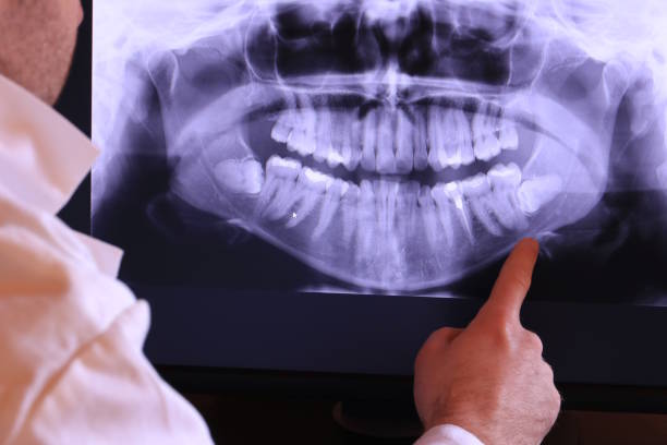 Best Mobile Emergency Dentist in South San Jose Hills, CA